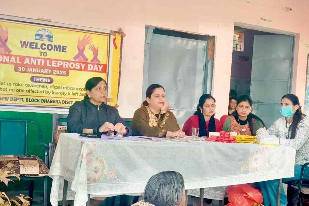 Leprosy Chronic Infection: Ajay Pathak